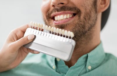 dental veneers in Livonia