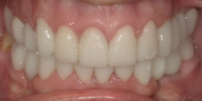0504-after