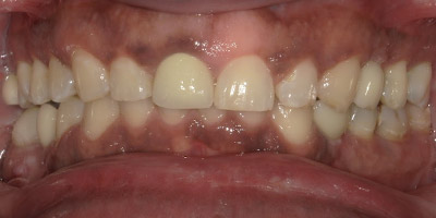 0507-after