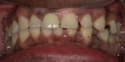 0507-before